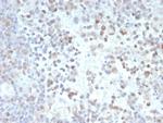 PRAME nuclear receptor transcriptional regulator Antibody in Immunohistochemistry (Paraffin) (IHC (P))