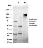 Fos-related antigen 2 (FRA-2)/FOS-like antigen 2 (FOSL2) Antibody in SDS-PAGE (SDS-PAGE)