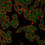 Fos-related antigen 2 (FRA-2)/FOS-like antigen 2 (FOSL2) Antibody in Immunocytochemistry (ICC/IF)