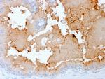 AMACR/p504S (Prostate Cancer Marker) Antibody in Immunohistochemistry (Paraffin) (IHC (P))