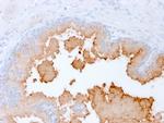 AMACR/p504S (Prostate Cancer Marker) Antibody in Immunohistochemistry (Paraffin) (IHC (P))