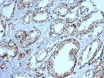 AMACR/p504S (Prostate Cancer Marker) Antibody in Immunohistochemistry (Paraffin) (IHC (P))