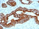 AMACR/p504S (Prostate Cancer Marker) Antibody in Immunohistochemistry (Paraffin) (IHC (P))