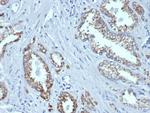 AMACR/p504S (Prostate Cancer Marker) Antibody in Immunohistochemistry (Paraffin) (IHC (P))