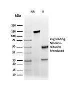 AMACR/p504S (Prostate Cancer Marker) Antibody in SDS-PAGE (SDS-PAGE)