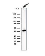 AMACR/p504S (Prostate Cancer Marker) Antibody in Western Blot (WB)