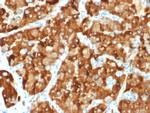 AMACR/p504S Antibody in Immunohistochemistry (Paraffin) (IHC (P))