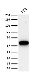 AMACR/p504S Antibody in Western Blot (WB)