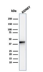 AMACR/p504S Antibody in Western Blot (WB)