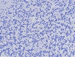 AMACR/p504S (Prostate Cancer Marker) Antibody in Immunohistochemistry (Paraffin) (IHC (P))