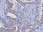 AMACR/p504S (Prostate Cancer Marker) Antibody in Immunohistochemistry (Paraffin) (IHC (P))