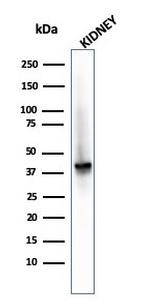 AMACR/p504S Antibody in Western Blot (WB)