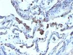 AMACR/p504S (Prostate Cancer Marker) Antibody in Immunohistochemistry (Paraffin) (IHC (P))