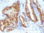 AMACR/p504S (Prostate Cancer Marker) Antibody in Immunohistochemistry (Paraffin) (IHC (P))