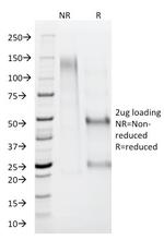 AMACR/p504S (Prostate Cancer Marker) Antibody in SDS-PAGE (SDS-PAGE)