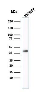 AMACR/p504S (Prostate Cancer Marker) Antibody in Western Blot (WB)