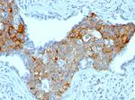 TRIM29 (Lung Squamous Cell Carcinoma Marker) Antibody in Immunohistochemistry (Paraffin) (IHC (P))