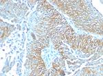 TRIM29 (Lung Squamous Cell Carcinoma Marker) Antibody in Immunohistochemistry (Paraffin) (IHC (P))