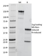 TRIM29 (Lung Squamous Cell Carcinoma Marker) Antibody in SDS-PAGE (SDS-PAGE)