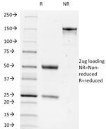 TRIM29 (Lung Squamous Cell Carcinoma Marker) Antibody in SDS-PAGE (SDS-PAGE)