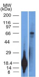 TRIM29 (Lung Squamous Cell Carcinoma Marker) Antibody in Western Blot (WB)