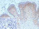 TRIM29 (Lung Squamous Cell Carcinoma Marker) Antibody in Immunohistochemistry (Paraffin) (IHC (P))