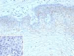 TRIM29 (Lung Squamous Cell Carcinoma Marker) Antibody in Immunohistochemistry (Paraffin) (IHC (P))