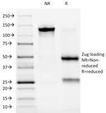 ALK (Anaplastic Lymphoma Kinase)/CD246 Antibody in SDS-PAGE (SDS-PAGE)