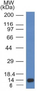 ALK (Anaplastic Lymphoma Kinase)/CD246 Antibody in Western Blot (WB)