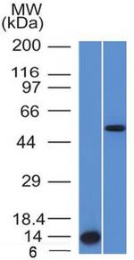 ALK (Anaplastic Lymphoma Kinase)/CD246 Antibody in Western Blot (WB)