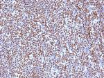 ALK (Anaplastic Lymphoma Kinase)/CD246 Antibody in Immunohistochemistry (Paraffin) (IHC (P))