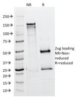 ALK (Anaplastic Lymphoma Kinase)/CD246 Antibody in SDS-PAGE (SDS-PAGE)