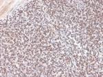 ALK (Anaplastic Lymphoma Kinase)/CD246 Antibody in Immunohistochemistry (Paraffin) (IHC (P))