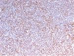 ALK (Anaplastic Lymphoma Kinase)/CD246 Antibody in Immunohistochemistry (Paraffin) (IHC (P))