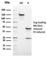 ALK (Anaplastic Lymphoma Kinase)/CD246 Antibody in SDS-PAGE (SDS-PAGE)