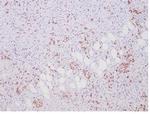 ALK (Anaplastic Lymphoma Kinase)/CD246 Antibody in Immunohistochemistry (Paraffin) (IHC (P))