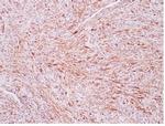 ALK (Anaplastic Lymphoma Kinase)/CD246 Antibody in Immunohistochemistry (Paraffin) (IHC (P))