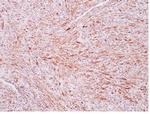 ALK (Anaplastic Lymphoma Kinase)/CD246 Antibody in Immunohistochemistry (Paraffin) (IHC (P))