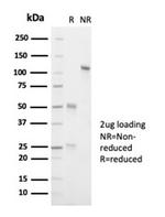 ALK (Anaplastic Lymphoma Kinase)/CD246 Antibody in SDS-PAGE (SDS-PAGE)