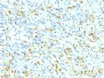 ALK (Anaplastic Lymphoma Kinase)/CD246 Antibody in Immunohistochemistry (Paraffin) (IHC (P))