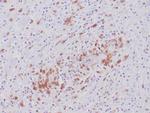 ALK (Anaplastic Lymphoma Kinase)/CD246 Antibody in Immunohistochemistry (Paraffin) (IHC (P))