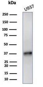 LAMP5 (Late Endosomes Marker) Antibody in Western Blot (WB)