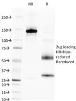 Alkaline Phosphatase (Tissue-Nonspecific) Antibody in SDS-PAGE (SDS-PAGE)