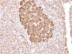 Ferritin, Heavy Chain (FTH) Antibody in Immunohistochemistry (Paraffin) (IHC (P))