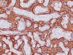 Alkaline Phosphatase (Placental)/PLAP (Germ Cell Tumor Marker) Antibody in Immunohistochemistry (Paraffin) (IHC (P))