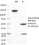 Alkaline Phosphatase (Placental)/PLAP (Germ Cell Tumor Marker) Antibody in SDS-PAGE (SDS-PAGE)