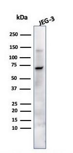 Alkaline Phosphatase (Placental)/PLAP (Germ Cell Tumor Marker) Antibody in Western Blot (WB)