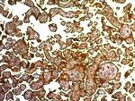 Placental Alkaline Phosphatase (PLAP) (Germ Cell Tumor Marker) Antibody in Immunohistochemistry (Paraffin) (IHC (P))