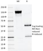 Alkaline Phosphatase (Placental)/PLAP (Germ Cell Tumor Marker) Antibody in SDS-PAGE (SDS-PAGE)