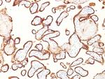 Alkaline Phosphatase (Placental)/PLAP (Germ Cell Tumor Marker) Antibody in Immunohistochemistry (Paraffin) (IHC (P))